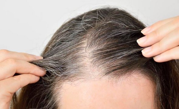 白头发越长越多，你以为是老了，其实是缺这3种营养